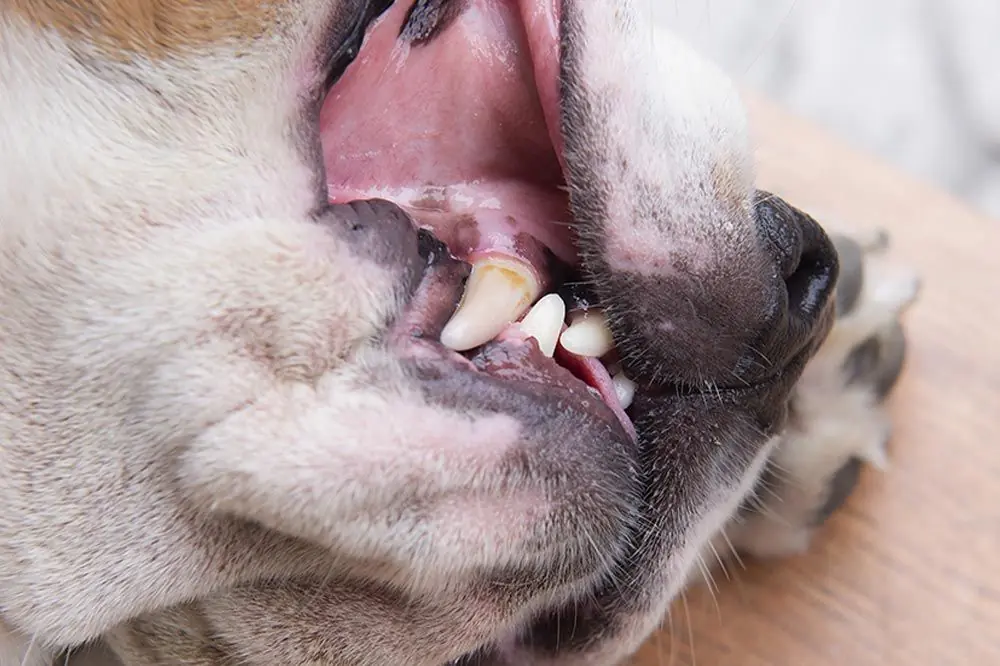 Come trattare le ulcere della bocca